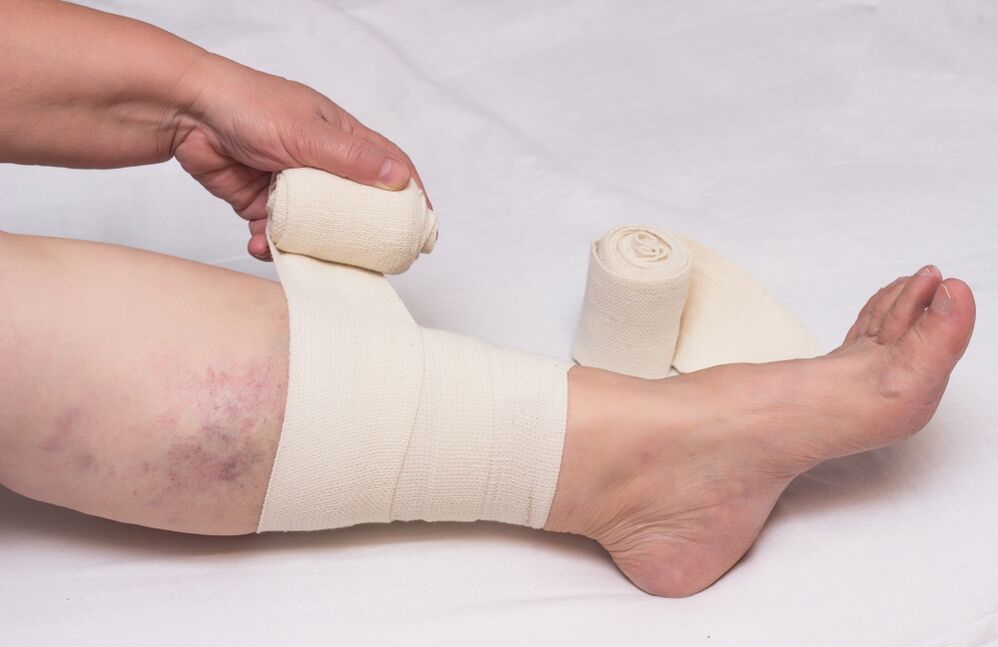 Elastobiin
